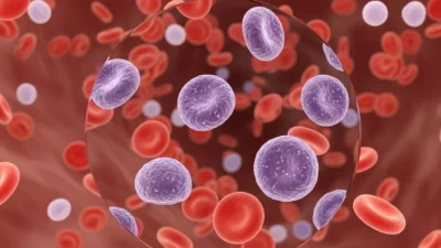 mean platelet volume high